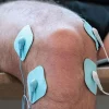 Electrodes Bluepack S et M
